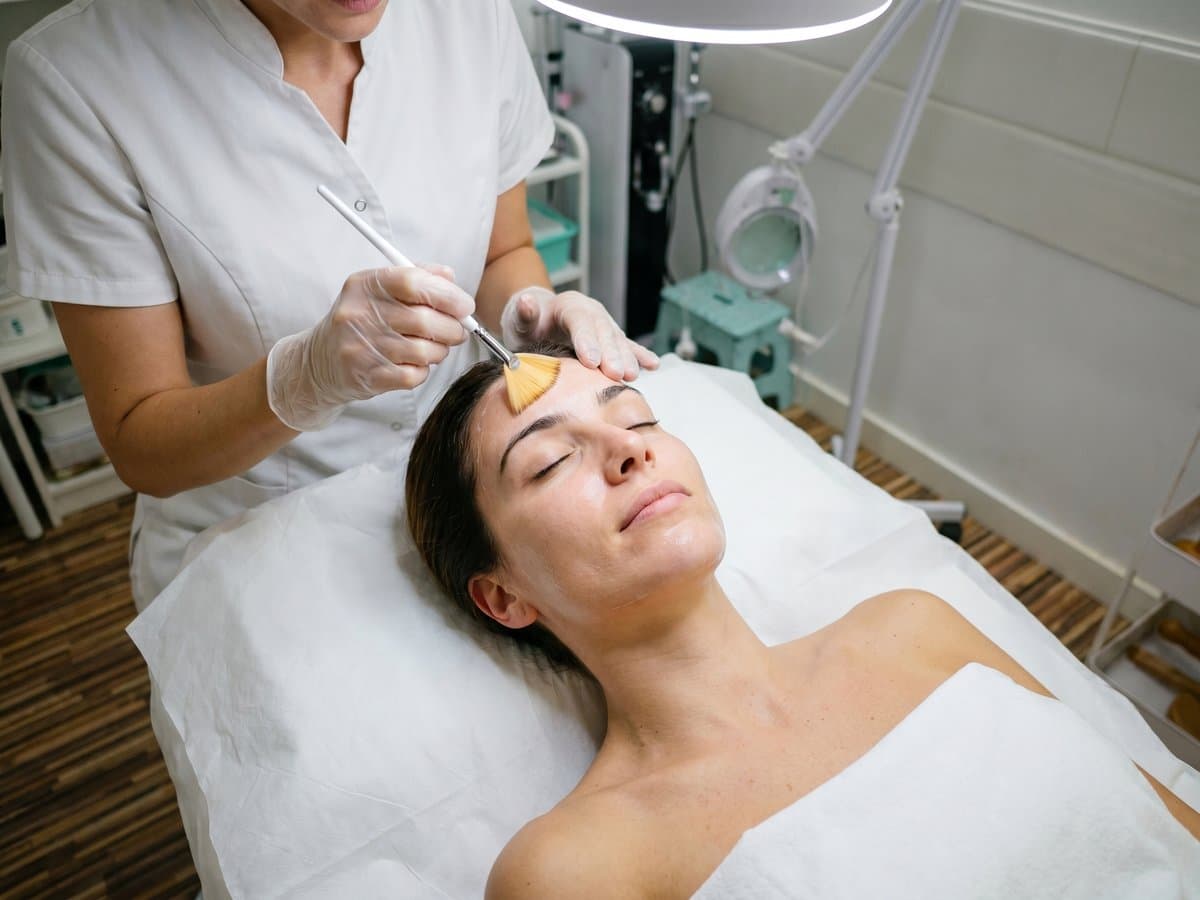 Peeling químico facial — Clínica Pura Vida Valencia