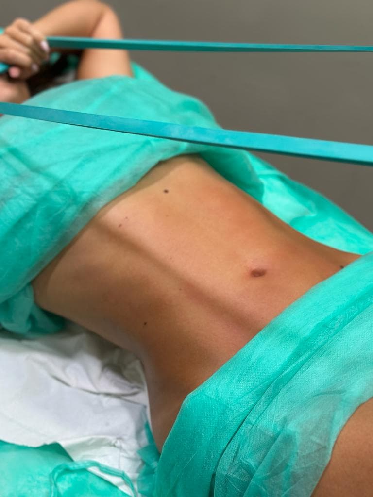 Tratamiento corporal Total Body en consulta — Clínica Pura Vida Valencia